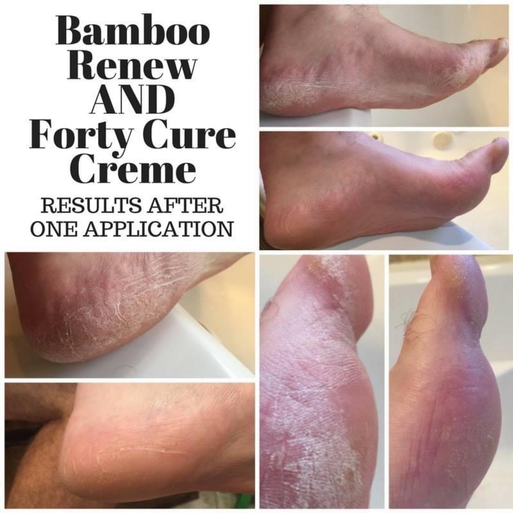 renew body collection